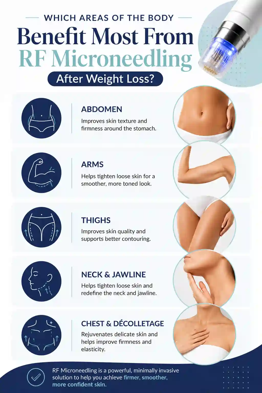Which Areas of the Body Benefit Most From RF Microneedling After Weight Loss Ross-on-Wye
